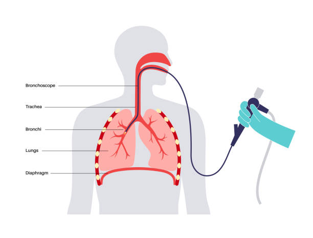 Best Doctor for Bronchoscopy in Ghodbunder Road,Thane
